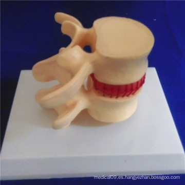 Esqueleto Humano Vertebra Columna Demostración Médica Biología Modelo